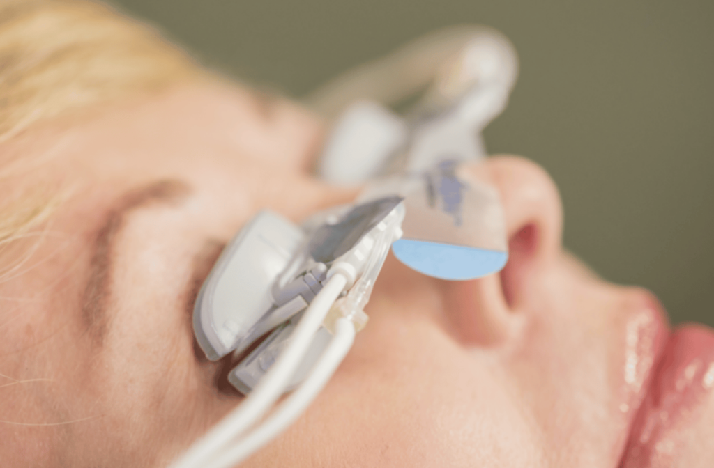 Person undergoing LipiFlow treatment with eye devices applied to the eyelids.